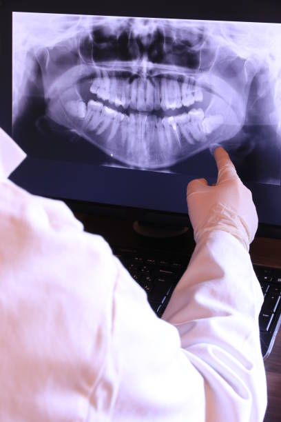 Best Emergency Treatment for Toothache in Berly, MO