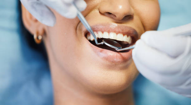 Best Emergency Broken Tooth Repair in Berly, MO