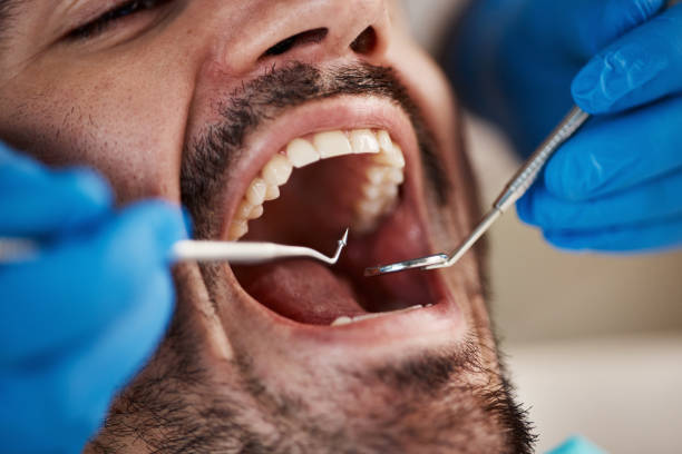 Best After-Hours Emergency Dentist in Berly, MO