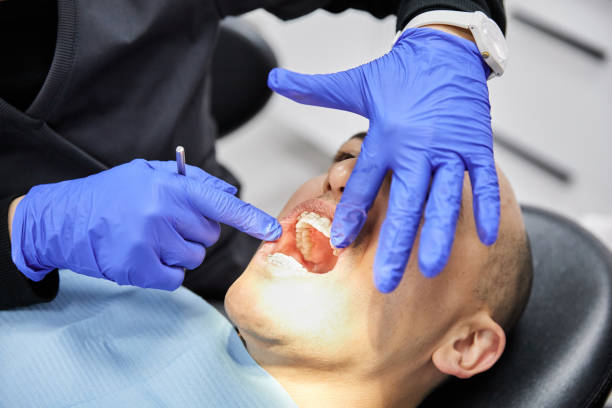 Best Emergency Tooth Extraction in Berly, MO